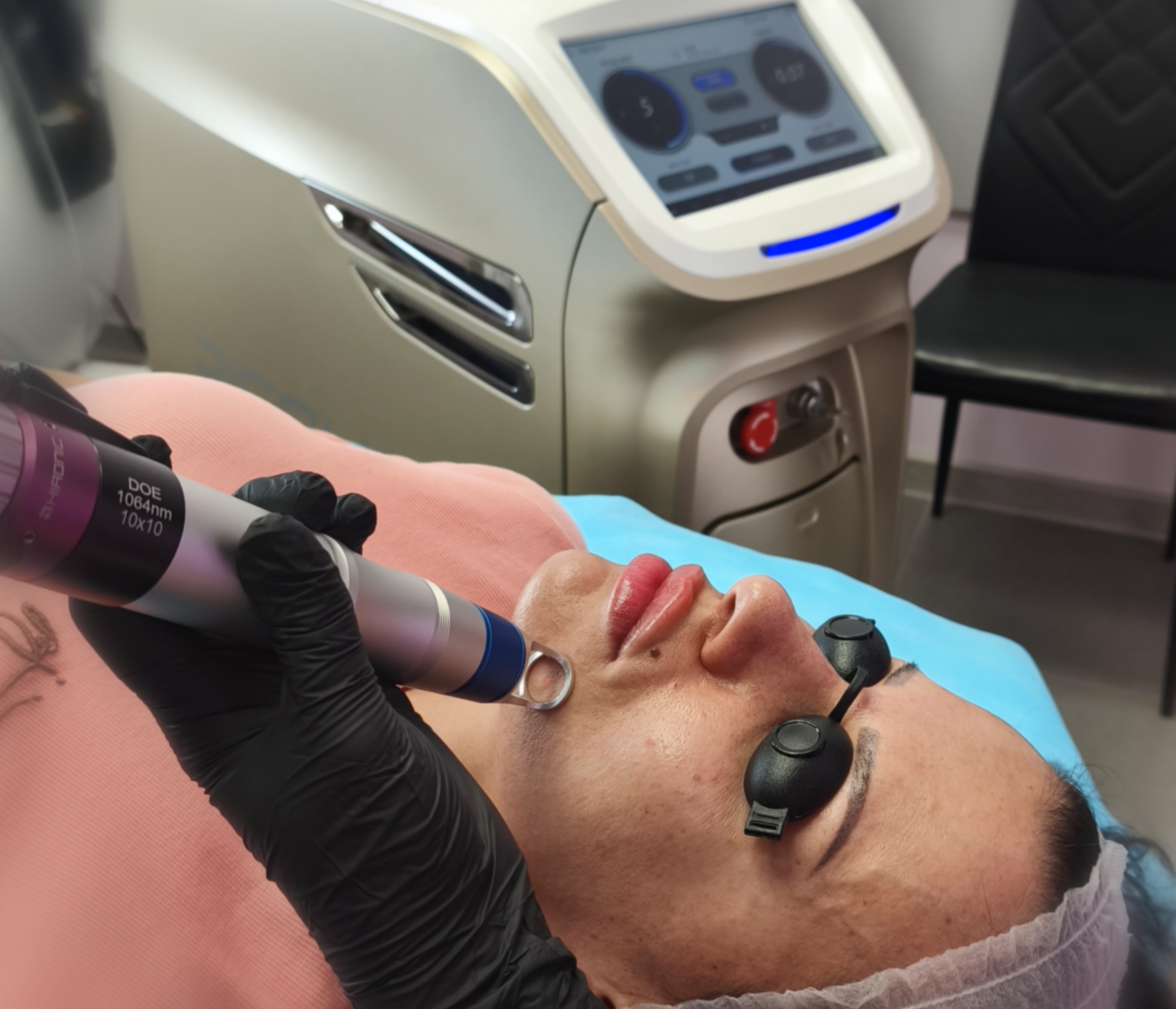 Лазерно подмладяване