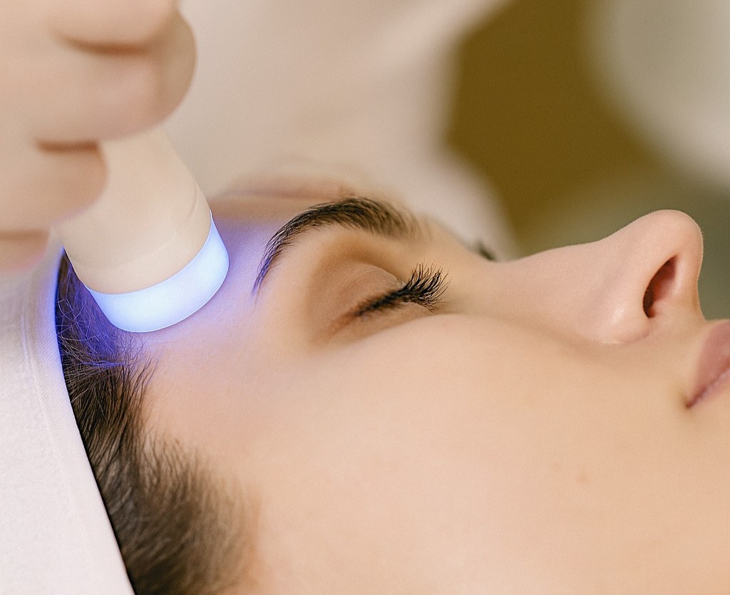 Радиочестотен лифтинг с Refit – Адара