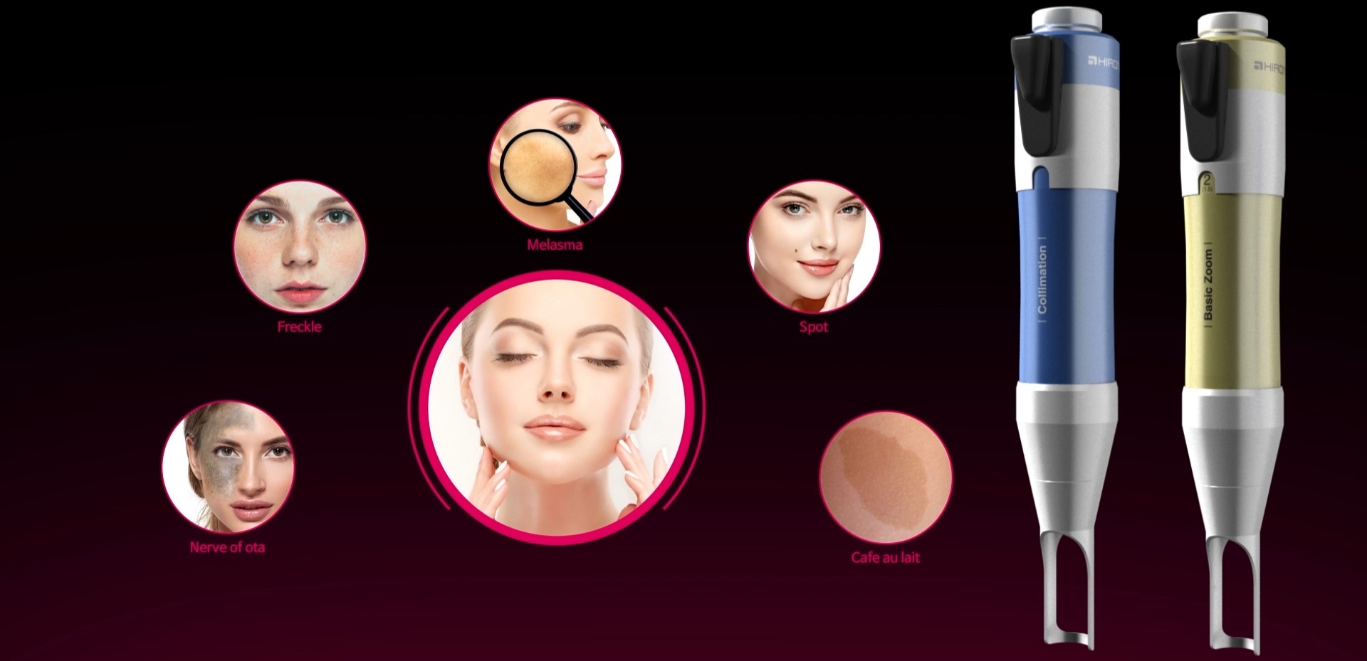 Пигментни петна – Адара Русе